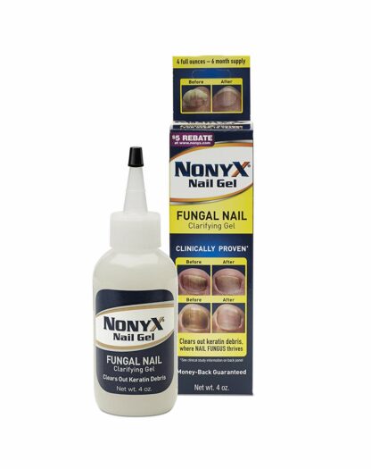 Nonyx Nail Gel, 4.0 OZ (Pack of 2)