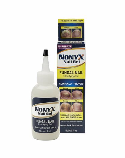 NONYX Fungal Nail Clarifying Gel, Clears Out Keratin Debris Where Nail Fungus Thrives, 4 oz.